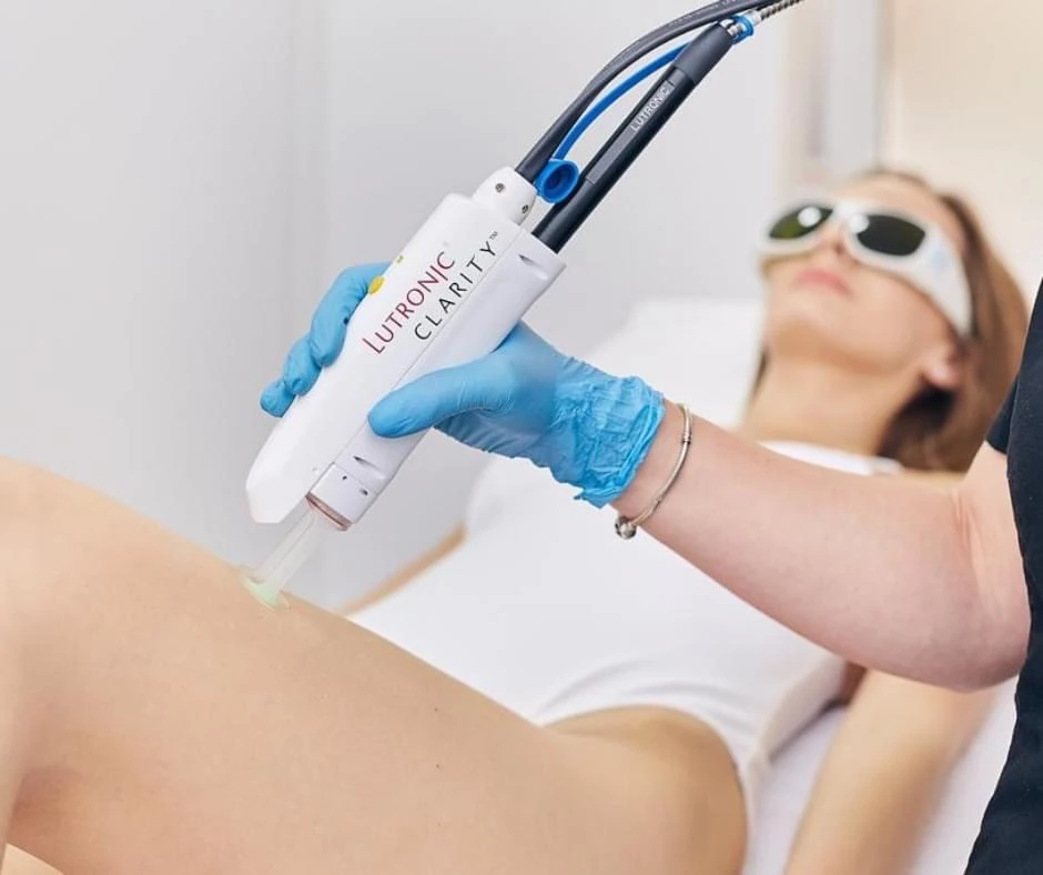 Séance d’épilation des aisselles avec un appareil laser
